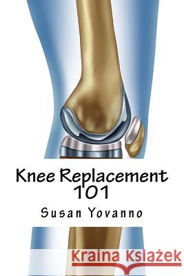 Knee Replacement 101: A User's Guide to Preparation for and Recovery After Knee Arthroplasty Susie Yovanno 9780692491959 Physiosolutions Press - książka