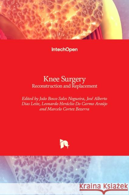 Knee Surgery: Reconstruction and Replacement Jo Nogueira Jos 9781838805302 Intechopen - książka