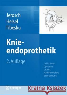 Knieendoprothetik: Indikationen, Operationstechnik, Nachbehandlung, Begutachtung Jerosch, Jörg 9783642384226 Springer - książka