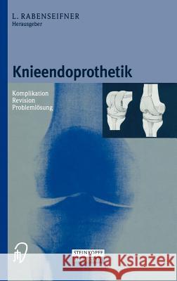 Knieendoprothetik: Komplikation - Revision - Problemlösung Rabenseifner, Lothar 9783798511330 Steinkopff-Verlag Darmstadt - książka