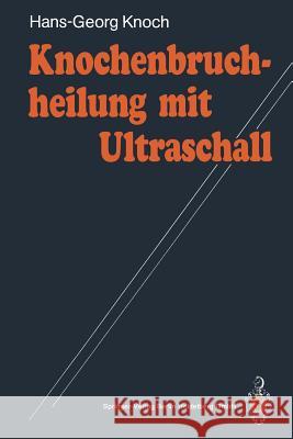 Knochenbruchheilung Mit Ultraschall Hans-Georg Knoch 9783540523024 Not Avail - książka