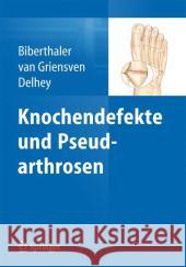 Knochendefekte Und Pseudarthrosen Biberthaler, Peter 9783642449901 Springer - książka