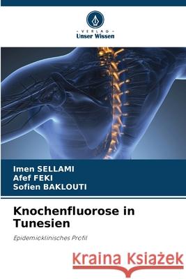 Knochenfluorose in Tunesien Imen Sellami Afef Feki Sofien Baklouti 9786207546947 Verlag Unser Wissen - książka