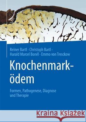 Knochenmarködem: Formen, Pathogenese, Diagnose und Therapie Reiner Bartl Christoph Bartl Harald Marcel Bon?l 9783662671337 Springer - książka