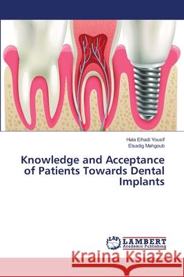 Knowledge and Acceptance of Patients Towards Dental Implants Elhadi Yousif, Hala; Mahgoub, Elsadig 9786139825219 LAP Lambert Academic Publishing - książka