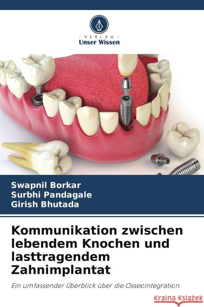 Kommunikation zwischen lebendem Knochen und lasttragendem Zahnimplantat Swapnil Borkar Surbhi Pandagale Girish Bhutada 9786206884743 Verlag Unser Wissen - książka