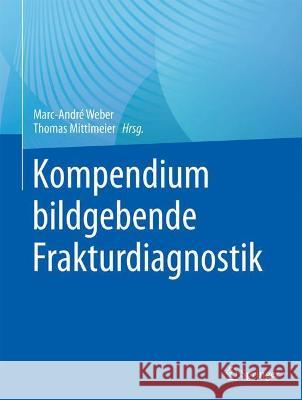 Kompendium Bildgebende Frakturdiagnostik Marc-Andr Weber Thomas Mittlmeier Ulrich Linsenmaier 9783662636015 Springer - książka