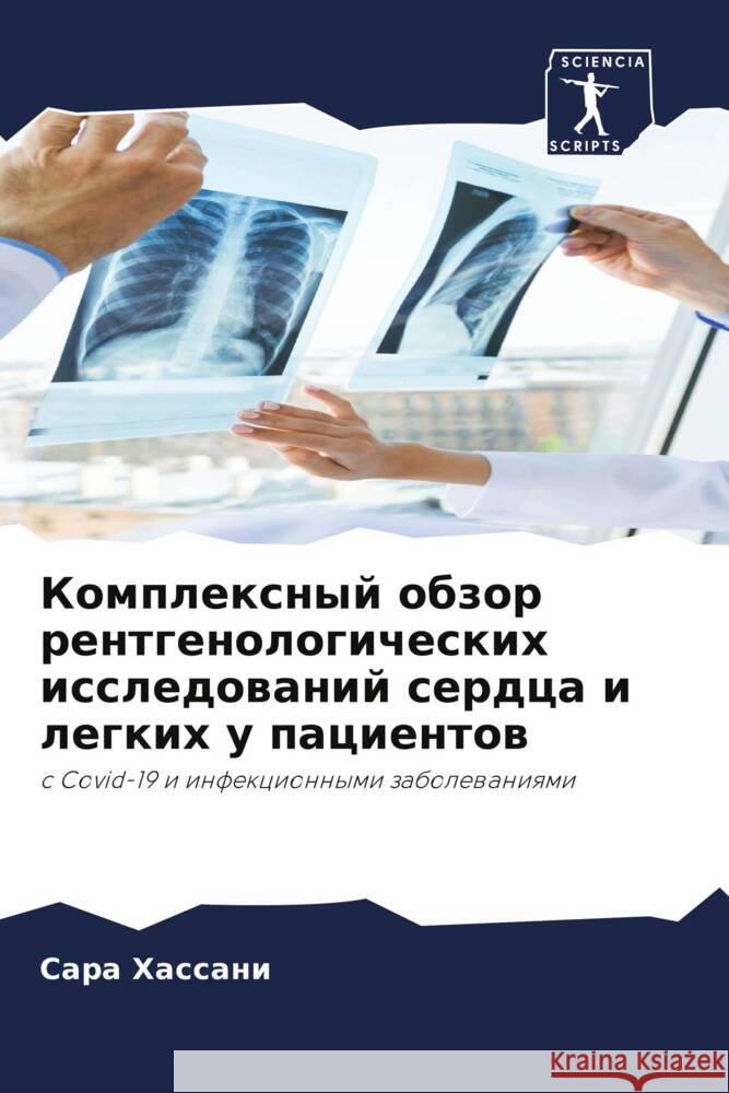 Komplexnyj obzor rentgenologicheskih issledowanij serdca i legkih u pacientow Hassani, Sara 9786206286141 Sciencia Scripts - książka