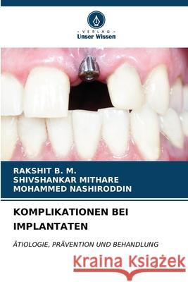 Komplikationen Bei Implantaten Rakshit B Shivshankar Mithare Mohammed Nashiroddin 9786207122004 Verlag Unser Wissen - książka