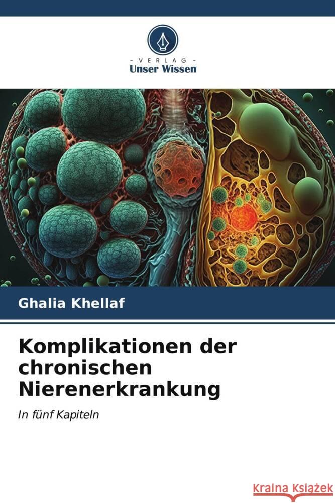 Komplikationen der chronischen Nierenerkrankung KHELLAF, Ghalia 9786207042258 Verlag Unser Wissen - książka