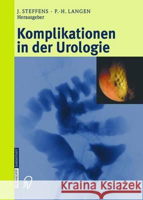 Komplikationen in Der Urologie Steffens, Joachim 9783642632808 Steinkopff-Verlag Darmstadt - książka