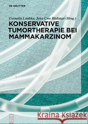 Konservative Tumortherapie Beim Mammakarzinom Kolberg-Liedtke, Cornelia 9783110577419 de Gruyter - książka