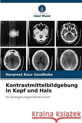 Kontrastmittelbildgebung in Kopf und Hals Harpreet Kaur Gandhoke 9786204497020 Verlag Unser Wissen - książka