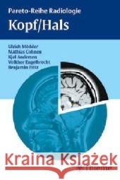 Kopf/Hals Mödder, Ulrich Cohnen, Mathias Andersen, Kjel  9783131371218 Thieme, Stuttgart - książka