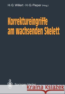Korrektureingriffe Am Wachsenden Skelett Willert, H. -G 9783540512097 Not Avail - książka