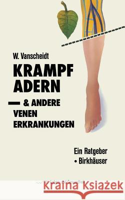 Krampfadern Und Andere Venenerkrankungen: Ein Ratgeber Vanscheidt, W. 9783764319144 Springer - książka