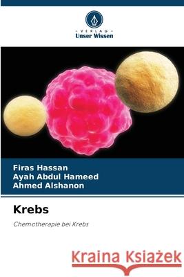 Krebs Hassan, Firas, Abdul Hameed, Ayah, Alshanon, Ahmed 9786209248733 Verlag Unser Wissen - książka