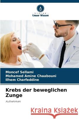 Krebs der beweglichen Zunge Moncef Sellami Mohamed Amine Chaabouni Ilhem Charfeddine 9786205232897 Verlag Unser Wissen - książka