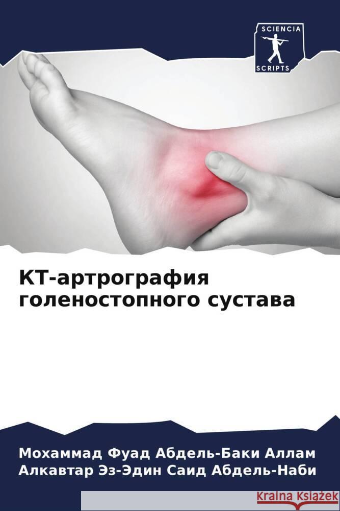 KT-artrografiq golenostopnogo sustawa Allam, Mohammad Fuad Abdel'-Baki, Abdel'-Nabi, Alkawtar Jez-Jedin Said 9786208019778 Sciencia Scripts - książka
