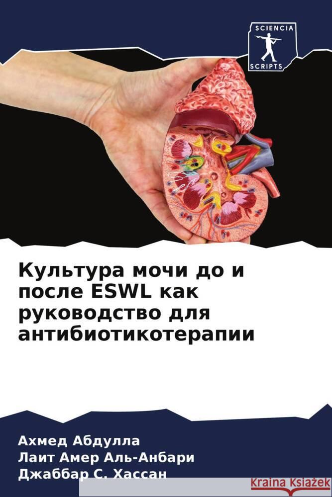 Kul'tura mochi do i posle ESWL kak rukowodstwo dlq antibiotikoterapii Abdulla, Ahmed, Al'-Anbari, Lait Amer, Hassan, Dzhabbar S. 9786205055564 Sciencia Scripts - książka