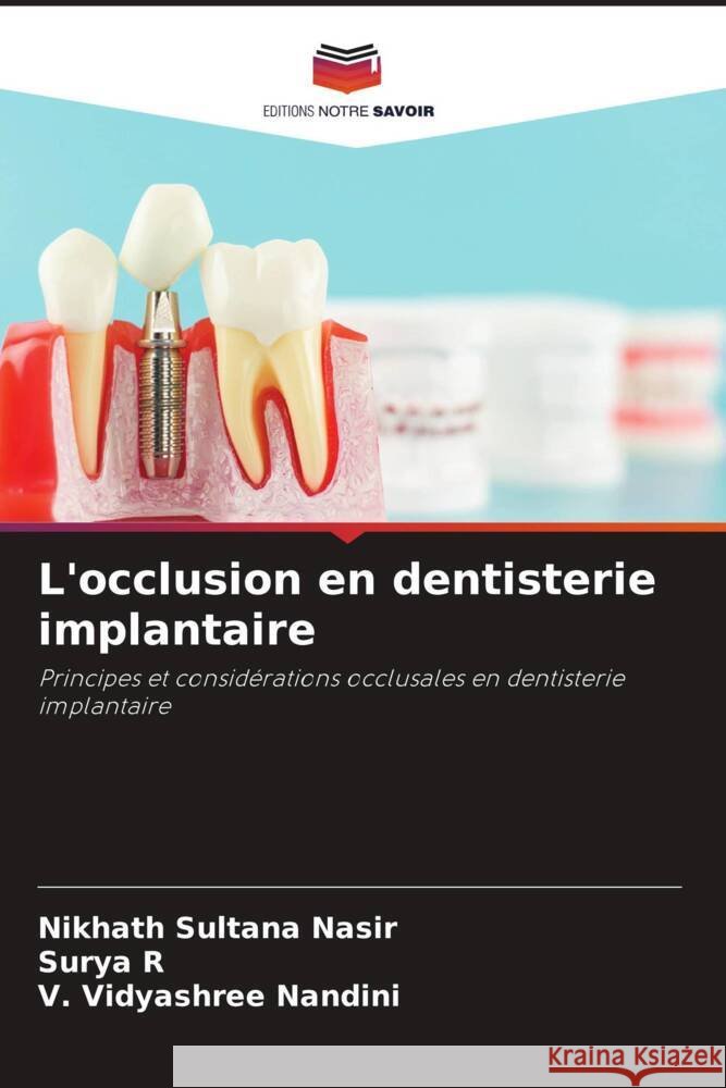 L'occlusion en dentisterie implantaire Sultana Nasir, Nikhath, R, Surya, Nandini, V. Vidyashree 9786204767413 Editions Notre Savoir - książka