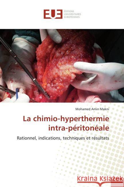 La chimio-hyperthermie intra-péritonéale : Rationnel, indications, techniques et résultats Makni, Mohamed Amin 9783330874640 Éditions universitaires européennes - książka