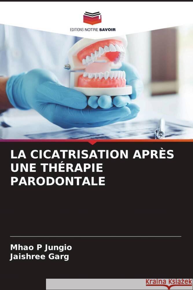 La Cicatrisation Apres Une Therapie Parodontale Mhao P Jungio Jaishree Garg  9786205913376 Editions Notre Savoir - książka