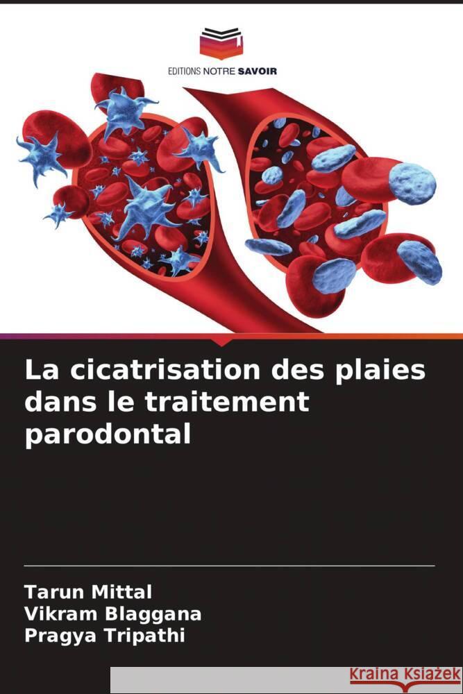 La cicatrisation des plaies dans le traitement parodontal Mittal, Tarun, Blaggana, Vikram, Tripathi, Pragya 9786205112687 Editions Notre Savoir - książka