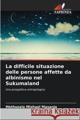 La difficile situazione delle persone affette da albinismo nel Sukumaland Methusela Mishael Masanja 9786209247965 Edizioni Sapienza - książka