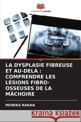 LA DYSPLASIE FIBREUSE ET AU-DELÀ : COMPRENDRE LES LÉSIONS FIBRO-OSSEUSES DE LA MÂCHOIRE RAKHA, MONIKA 9786208727703 Editions Notre Savoir - książka