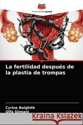La fertilidad después de la plastia de trompas Belghith, Cyrine 9786204040943 Editions Notre Savoir - książka