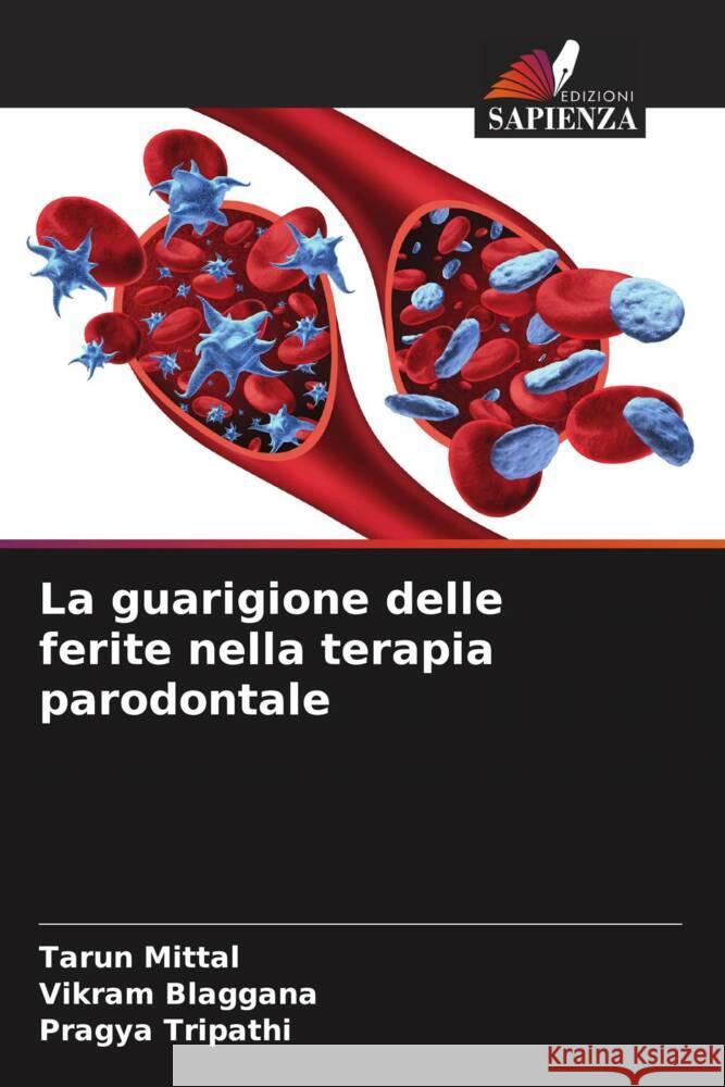 La guarigione delle ferite nella terapia parodontale Mittal, Tarun, Blaggana, Vikram, Tripathi, Pragya 9786205112694 Edizioni Sapienza - książka