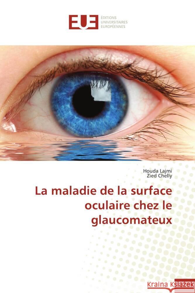 La maladie de la surface oculaire chez le glaucomateux Lajmi, Houda, Chelly, Zied 9783330872813 Éditions universitaires européennes - książka
