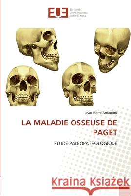 La maladie osseuse de paget Arnautou-J 9786131547348 Editions Universitaires Europeennes - książka