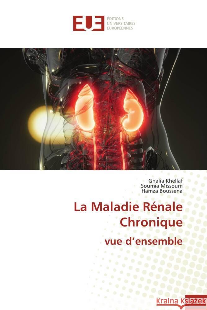 La Maladie Rénale Chronique vue d'ensemble KHELLAF, Ghalia, MISSOUM, Soumia, Boussena, Hamza 9786206698289 Éditions universitaires européennes - książka