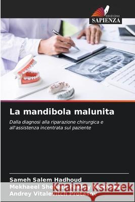 La mandibola malunita Hadhoud, Sameh Salem, Mekhaeel, Mekhaeel Shehata Fakhry, Protasov, Andrey Vitalevitch 9786209252082 Edizioni Sapienza - książka