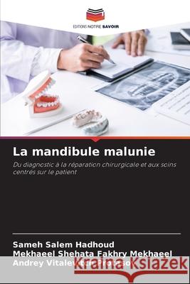 La mandibule malunie Hadhoud, Sameh Salem, Mekhaeel, Mekhaeel Shehata Fakhry, Protasov, Andrey Vitalevitch 9786209298158 Editions Notre Savoir - książka