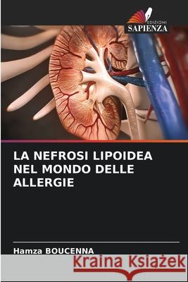 La Nefrosi Lipoidea Nel Mondo Delle Allergie Hamza Boucenna 9786207522613 Edizioni Sapienza - książka