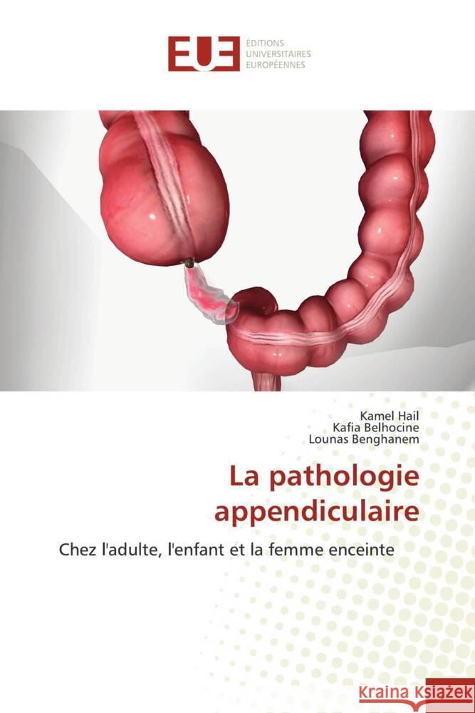 La pathologie appendiculaire Kamel Hail Kafia Belhocine Lounas Benghanem 9786206705802 Editions Universitaires Europeennes - książka