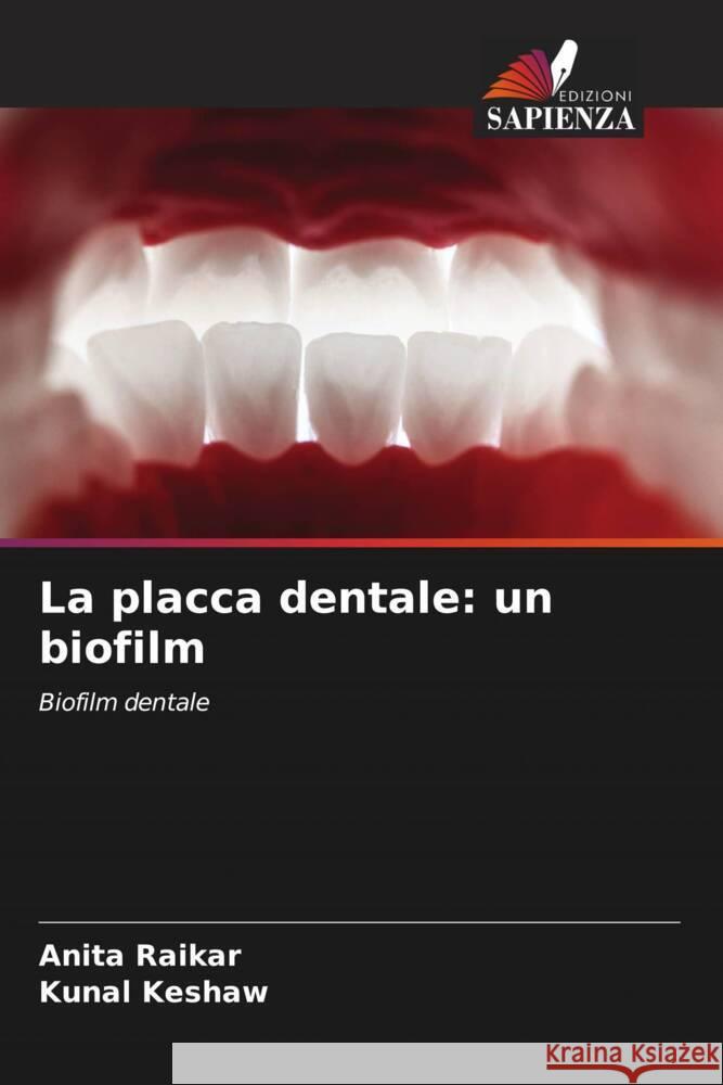 La placca dentale: un biofilm Anita Raikar Kunal Keshaw 9786203199215 Edizioni Sapienza - książka