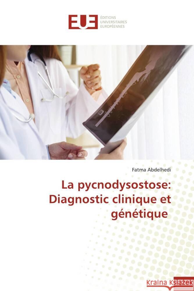 La pycnodysostose: Diagnostic clinique et g?n?tique Fatma Abdelhedi 9786206727101 Editions Universitaires Europeennes - książka
