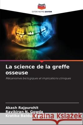 La science de la greffe osseuse Rajpurohit, Akash, N. Gowda, Ravikiran, Baldua Porwal, Kratika 9786208734459 Editions Notre Savoir - książka
