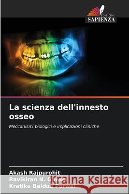 La scienza dell'innesto osseo Rajpurohit, Akash, N. Gowda, Ravikiran, Baldua Porwal, Kratika 9786208734466 Edizioni Sapienza - książka