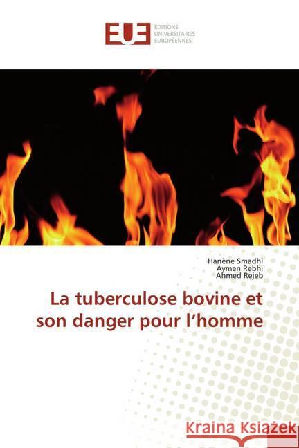 La tuberculose bovine et son danger pour l'homme Smadhi, Hanène; Rebhi, Aymen; Rejeb, Ahmed 9786202286138 Éditions universitaires européennes - książka