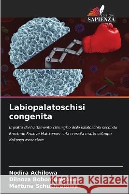 Labiopalatoschisi congenita Nodira Achilowa Dilnoza Bobomuratowa Maftuna Schukhratowa 9786205751374 Edizioni Sapienza - książka