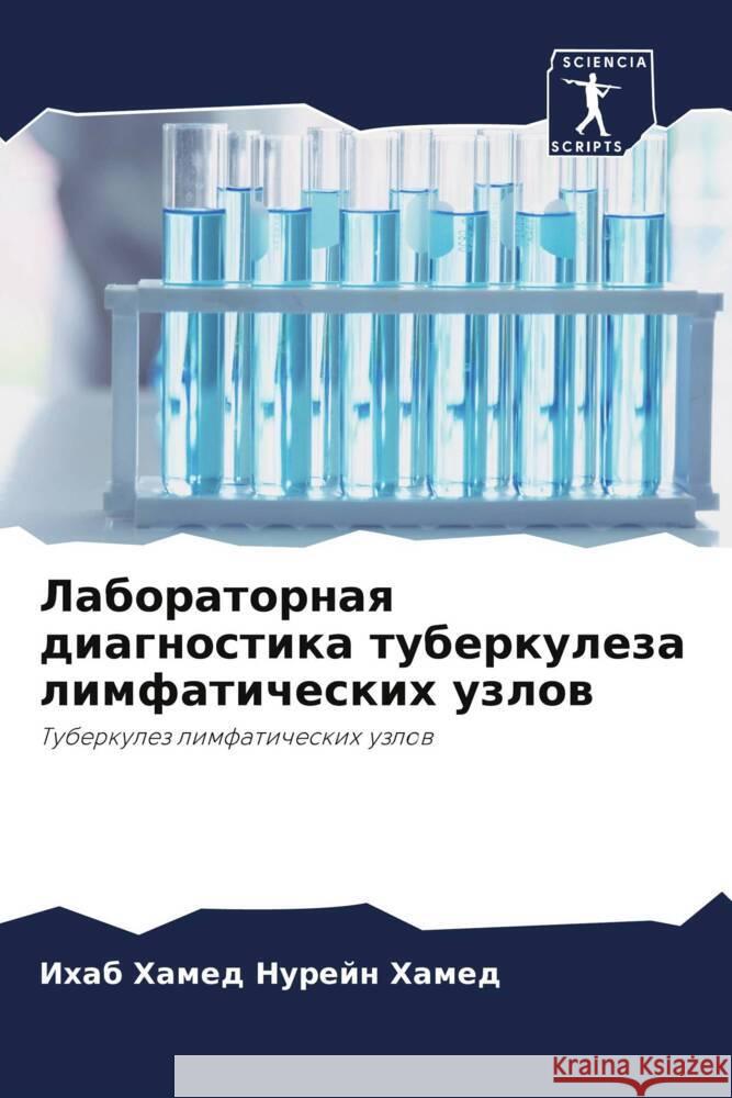 Laboratornaq diagnostika tuberkuleza limfaticheskih uzlow Nurejn Hamed, Ihab Hamed 9786208396602 Sciencia Scripts - książka