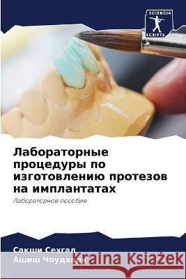 Laboratornye procedury po izgotowleniü protezow na implantatah Sehgal, Sakshi, Choudhari, Ashish 9786205932599 Sciencia Scripts - książka