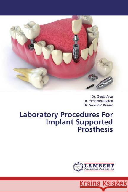 Laboratory Procedures For Implant Supported Prosthesis Arya, Dr. Geeta; Aeran, Dr. Himanshu; Kumar, Dr. Narendra 9786139933082 LAP Lambert Academic Publishing - książka