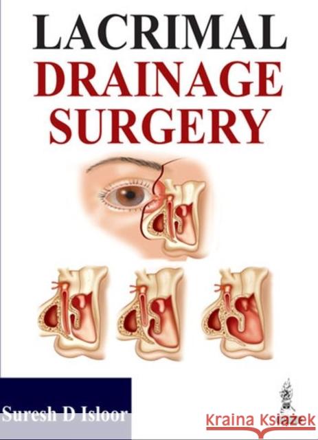 Lacrimal Drainage Surgery Suresh D. Isloor 9789350906507 Jp Medical Ltd - książka
