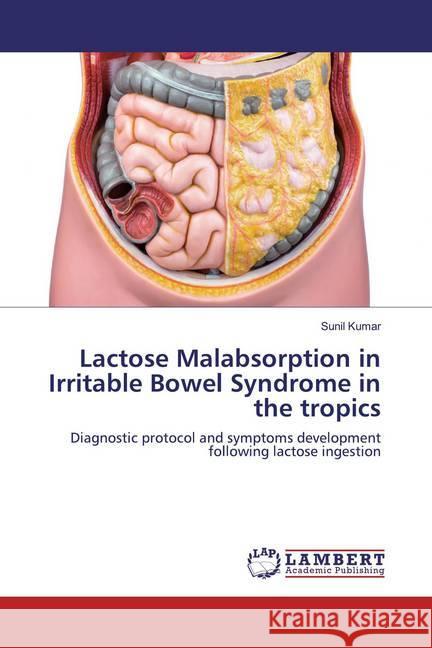 Lactose Malabsorption in Irritable Bowel Syndrome in the tropics : Diagnostic protocol and symptoms development following lactose ingestion Kumar, Sunil 9783659918063 LAP Lambert Academic Publishing - książka
